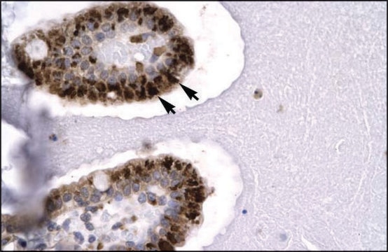 Anti-SIRT5 antibody produced in rabbit affinity isolated antibody