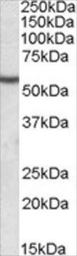 Anti-Desmin antibody produced in goat