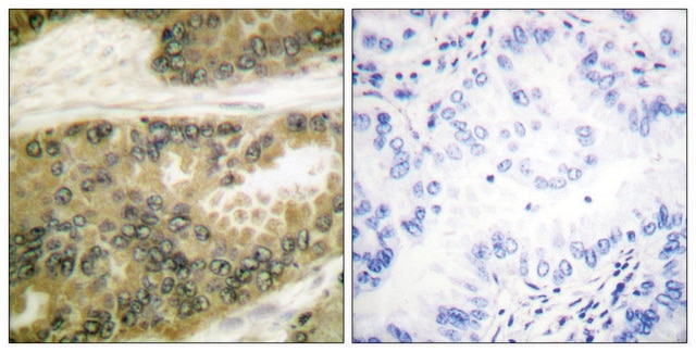 Anti-Cyclin D3 antibody produced in rabbit affinity isolated antibody