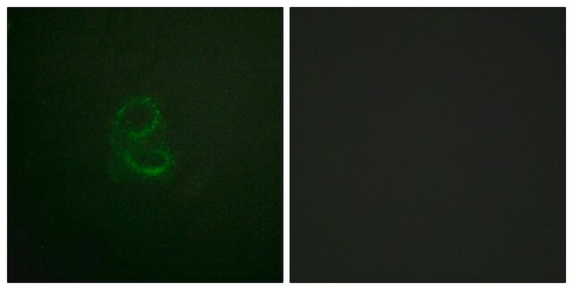 Anti-IL-4R antibody produced in rabbit affinity isolated antibody