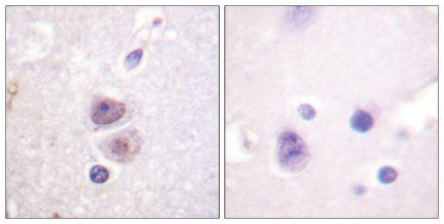 Anti-p38 MAPK antibody produced in rabbit affinity isolated antibody