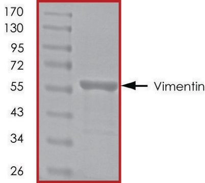 Vimentin, His tagged human recombinant, expressed in E. coli, &#8805;90% (SDS-PAGE), buffered aqueous glycerol solution