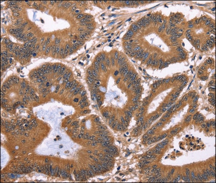 Anti-TDP2 antibody produced in rabbit affinity isolated antibody