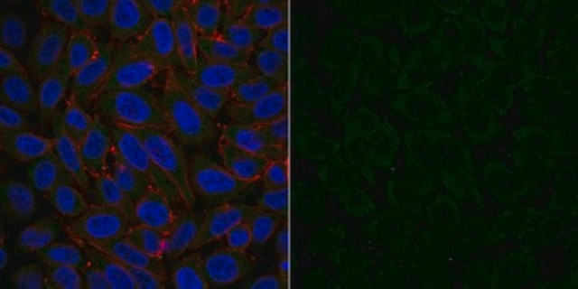 Anti-Dynein Antibody, IC, cytosolic, clone 74.1, Alexa Fluor&#8482; 488 Conjugate clone 74.1, from mouse, ALEXA FLUOR&#8482; 488