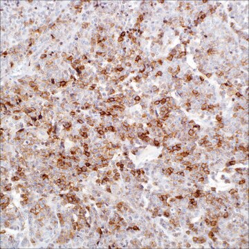 CD25 (4C9) Mouse Monoclonal Antibody