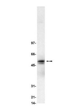 Anti-Lyn Antibody serum, Upstate&#174;