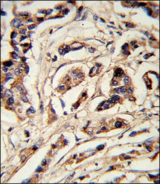 ANTI-TSHB (CENTER) antibody produced in rabbit IgG fraction of antiserum, buffered aqueous solution