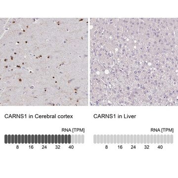 Anti-CARNS1 antibody produced in rabbit Prestige Antibodies&#174; Powered by Atlas Antibodies, affinity isolated antibody, buffered aqueous glycerol solution