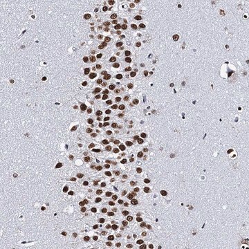 Anti-CMAS antibody produced in rabbit Prestige Antibodies&#174; Powered by Atlas Antibodies, affinity isolated antibody, buffered aqueous glycerol solution