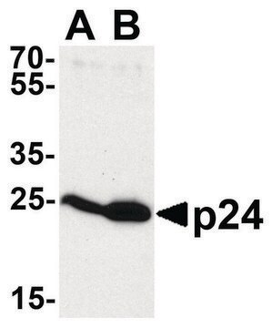 Anti-HIV-1 P24 antibody produced in rabbit affinity isolated antibody