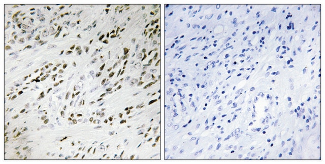 Anti-TSH2 antibody produced in rabbit affinity isolated antibody