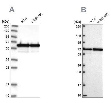 Anti-CCDC47 antibody produced in rabbit Prestige Antibodies&#174; Powered by Atlas Antibodies, affinity isolated antibody, buffered aqueous glycerol solution