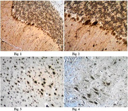 Anti-Cystatin-C Antibody from rabbit, purified by affinity chromatography