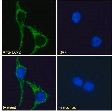 Anti-Uncoupling Protein 2/UCP2 antibody produced in goat affinity isolated antibody, buffered aqueous solution