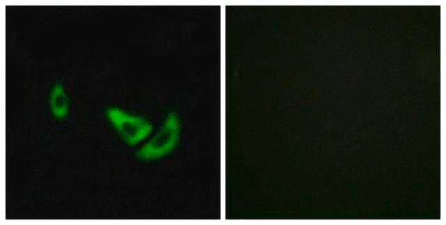 Anti-DCT antibody produced in rabbit affinity isolated antibody