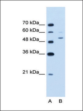 Anti-PBEF1 (AB1) antibody produced in rabbit IgG fraction of antiserum