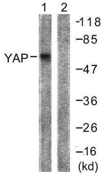 Anti-YAP antibody produced in rabbit affinity isolated antibody