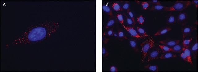 Anti-FMR1 (C-terminal) antibody produced in rabbit ~1.0&#160;mg/mL, affinity isolated antibody, buffered aqueous solution