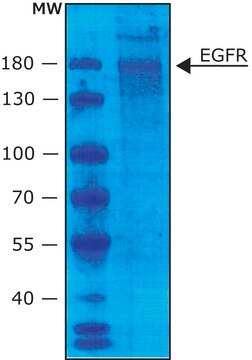 Epidermal Growth Factor Receptor human buffered aqueous glycerol solution, 5,000-30,000&#160;units/mg protein (Lowry)