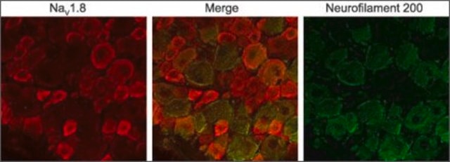 Anti-Sodium Channel NaV1.8 antibody produced in rabbit affinity isolated antibody, lyophilized powder