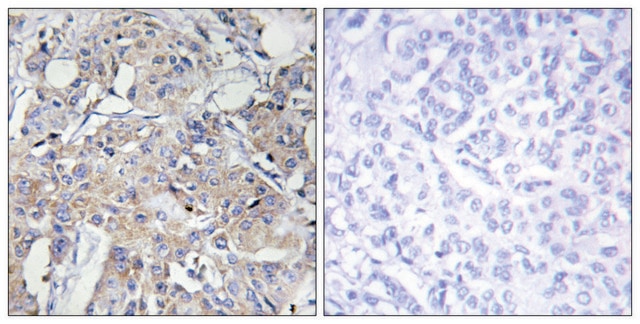 Anti-Collagen VI &#945;3 antibody produced in rabbit affinity isolated antibody