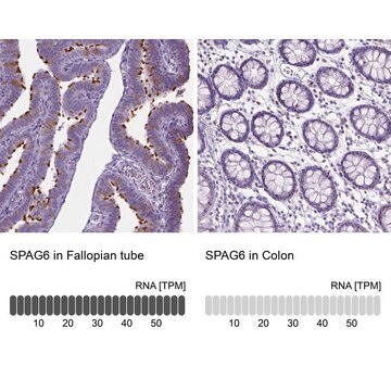 Anti-SPAG6 antibody produced in rabbit Prestige Antibodies&#174; Powered by Atlas Antibodies, affinity isolated antibody, buffered aqueous glycerol solution