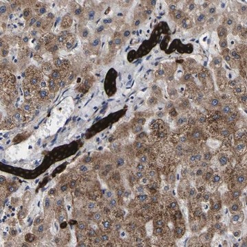 Anti-SCD antibody produced in rabbit Prestige Antibodies&#174; Powered by Atlas Antibodies, affinity isolated antibody, buffered aqueous glycerol solution