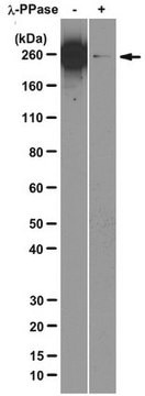 Anti-RNA polymerase II subunit B1 (phospho CTD Ser-2) Antibody, clone 3E10 clone 3E10, from rat