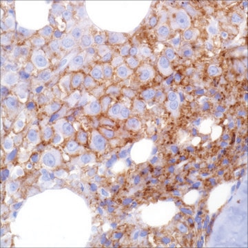 CD38 (SP149) Rabbit Monoclonal Antibody