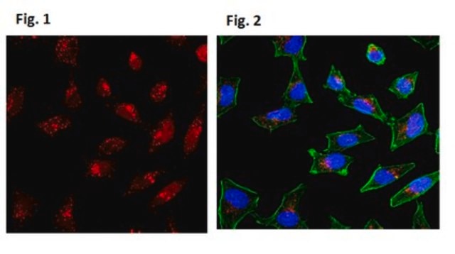 Anti-LC3-I/II Antibody from rabbit, purified by affinity chromatography