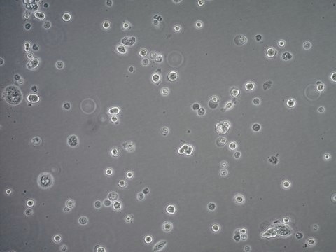 Calu-3 Human Lung Adenocarcinoma Cell Line