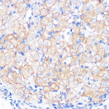 Anti-Occludin antibody produced in rabbit