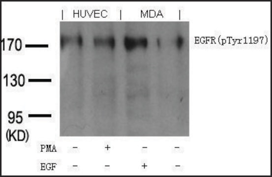 Anti-phospho-EGFR (pTyr1197) antibody produced in goat affinity isolated antibody