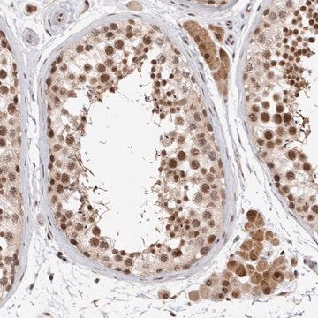 Anti-HESX1 antibody produced in rabbit Prestige Antibodies&#174; Powered by Atlas Antibodies, affinity isolated antibody, buffered aqueous glycerol solution