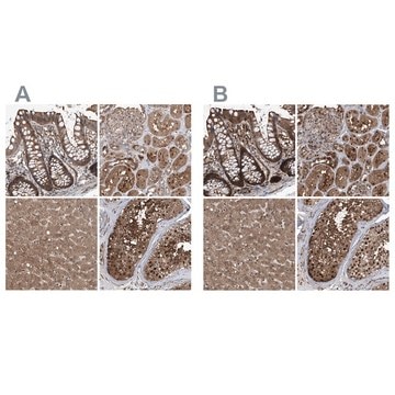 Anti-PSMB1 antibody produced in rabbit affinity isolated antibody, buffered aqueous glycerol solution, ab1