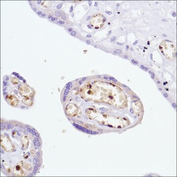 Anti-Haemoglobin Alpha Chain antibody, Rabbit monoclonal recombinant, expressed in proprietary host, clone SP212, affinity isolated antibody