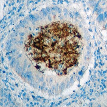 Anti-phospho-IR (pTyr1355) antibody produced in rabbit affinity isolated antibody