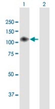 Anti-ENPP2 antibody produced in mouse purified immunoglobulin