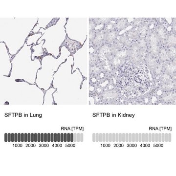 Anti-SFTPB antibody produced in rabbit Prestige Antibodies&#174; Powered by Atlas Antibodies, affinity isolated antibody, buffered aqueous glycerol solution