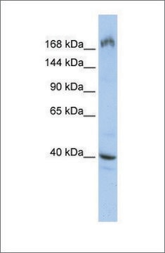 Anti-EIF4G1 antibody produced in rabbit affinity isolated antibody