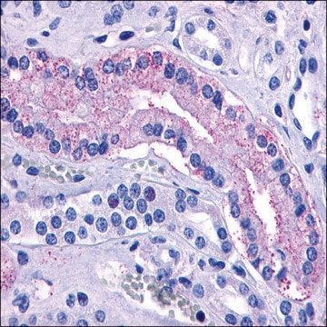 Anti-AVPR2 antibody produced in rabbit affinity isolated antibody