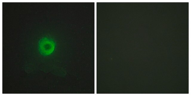 Anti-TNF Receptor II, antibody produced in rabbit affinity isolated antibody