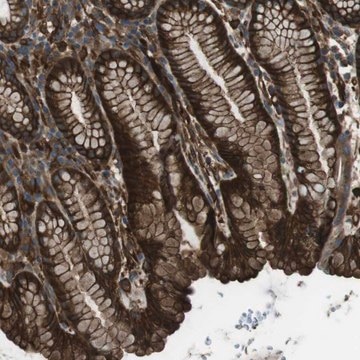 Anti-SFT2D1 antibody produced in rabbit Prestige Antibodies&#174; Powered by Atlas Antibodies, affinity isolated antibody, buffered aqueous glycerol solution