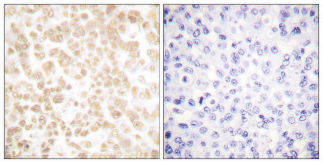 Anti-FRA-2 antibody produced in rabbit affinity isolated antibody