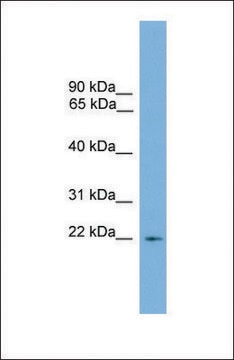 Anti-RGS10, (N-terminal) antibody produced in rabbit affinity isolated antibody