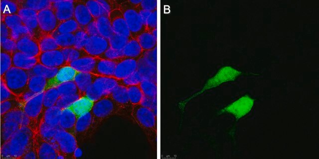 Anti-Chloramphenicol Acetyltransferase Antibody, clone CAT-1