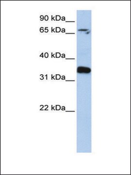 Anti-GLE1 antibody produced in rabbit affinity isolated antibody