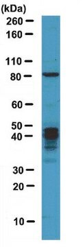 Anti-MBNL1 Antibody from rabbit, purified by affinity chromatography