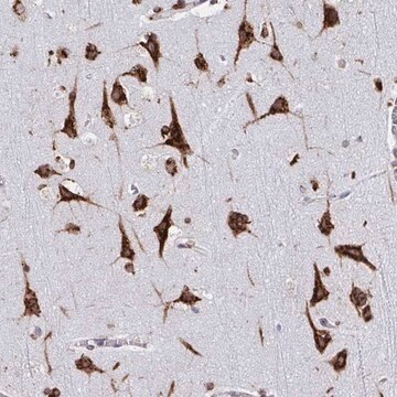 Anti-RFK antibody produced in rabbit Prestige Antibodies&#174; Powered by Atlas Antibodies, affinity isolated antibody, buffered aqueous glycerol solution