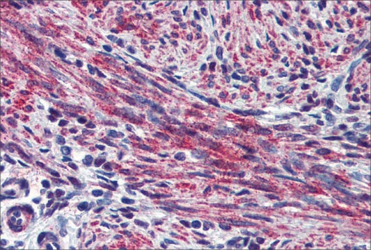 Anti-POSTN antibody produced in rabbit affinity isolated antibody